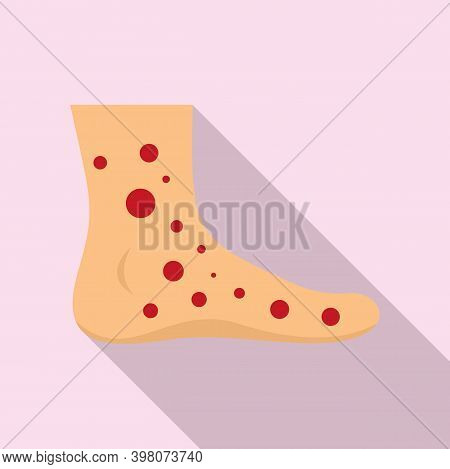 Foot Measles Icon. Flat Illustration Of Foot Measles Vector Icon For Web Design