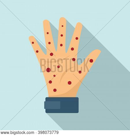 Hand Measles Icon. Flat Illustration Of Hand Measles Vector Icon For Web Design