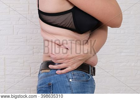 Young Woman Pinches The Fat On The Side Of Her Waist To Show The Flab, Overweighted Fat Body As S Re
