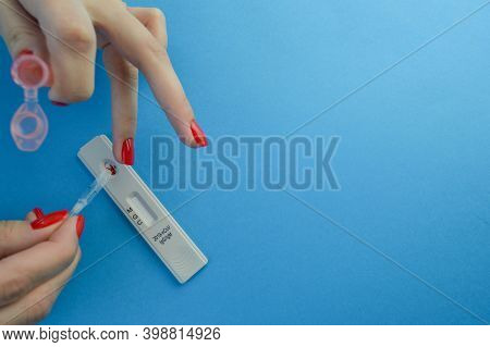 Positive Test Result By Using Rapid Test For Covid-19, Quick Fast Antibody Point Of Care Testing. La