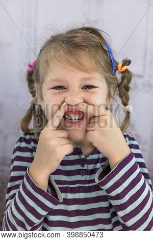 Adult Permanent Teeth Coming In Front Of The Child's Baby Teeth: Shark Teeth. Little Girl's Open Mou