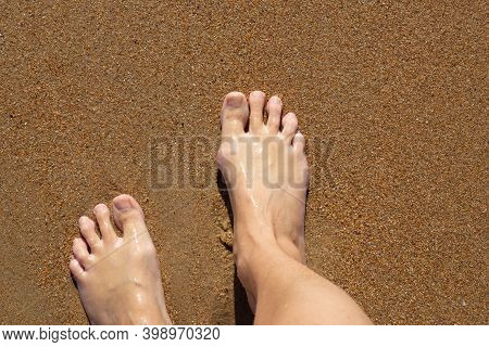 Womans Bare Feet On The Yellow Sand. Summer Rest. A Large Bone On The Toe Of The Right Foot.
