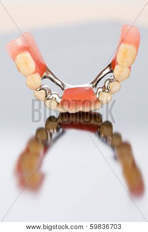 Lower Dental Prosthesis With Ceramic