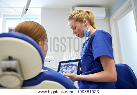 people, medicine, stomatology, technology and health care concept - female dentist showing teeth x-ray on tablet pc computer to patient girl at dental clinic office