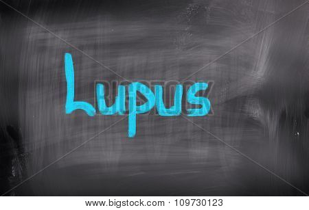 Concept Handwritten With Chalk On A Blackboard.