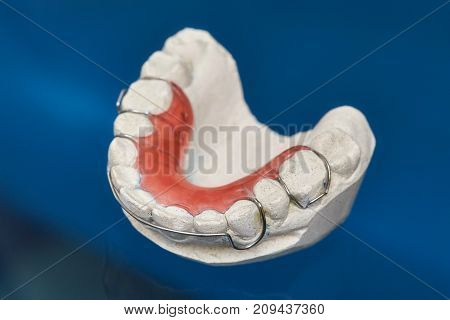 Colorful dental braces or retainers for teeth on black glass background closeup