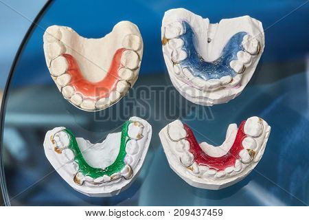 Colorful dental braces or retainers for teeth on black glass background closeup