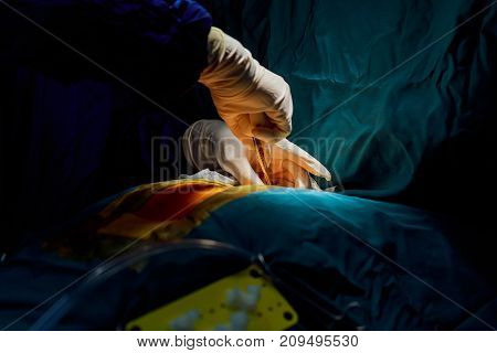 Cutting the chest during an operation on the heart Surgical breast opening during surgical operation.