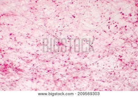 Human loose connective tissue, light photomicrograph, hematoxylin and eosin staining