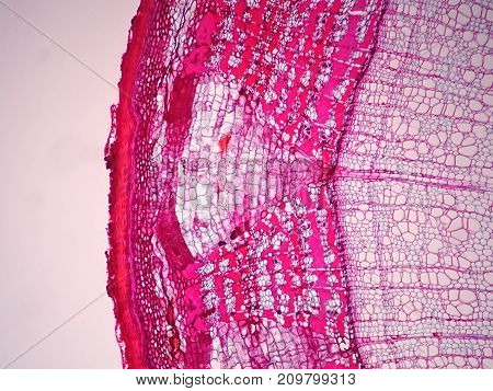Cross sections of plant stem under microscope view