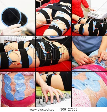 Myostimulation. Hardware cosmetology. Body care. Non surgical body sculpting. anti-cellulite and ant
