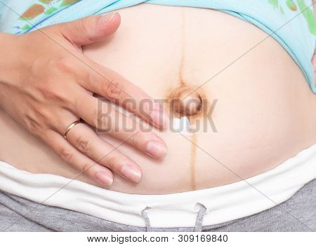 Modern Medical Cream To Eliminate Stretch Marks Of The Skin On The Abdomen And Brown Skin After Chil