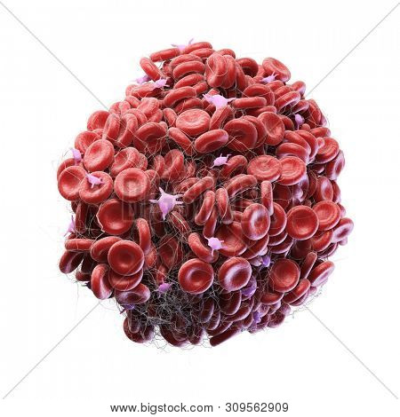 3d rendered medically accurate illustration of a blood clot
