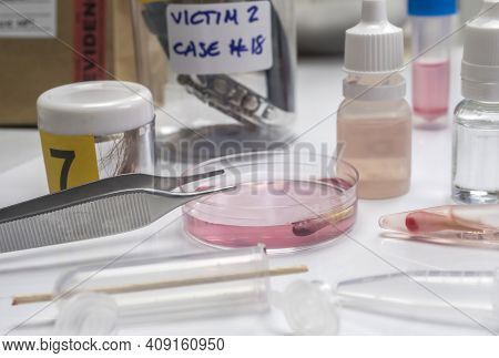 Hematological Analysis With Forensic Test Kit In A Murder In A Crime Lab, Conceptual Image