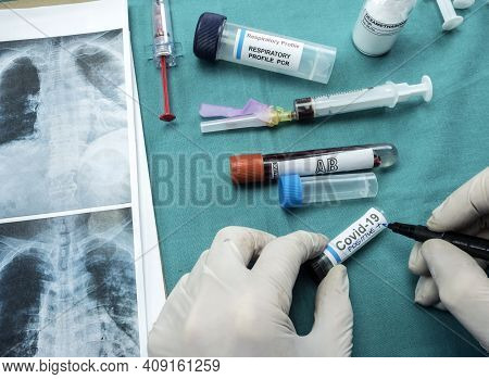 Nurse Writes Positive Result Of Patient Infected By Coronavirus Covid19 In A Laboratory, Spain