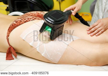 Woman Getting Cryolipolysis Fat Treatment Procedure On Hip In Beauty Salon