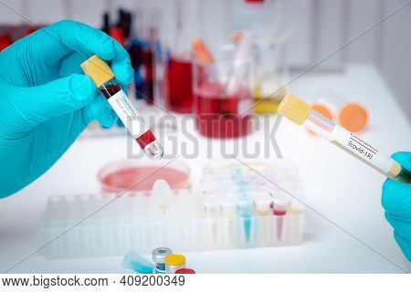 Test Tubes Containing Blood And Plasma Extracted From The Blood Of People Who Had Been Ill With Coro