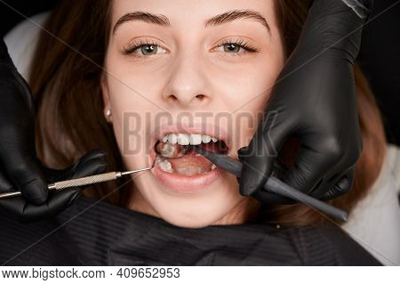 Close Up Of Dentist Examining Young Woman Teeth With Dental Mirror And Explorer. Patient With Open M