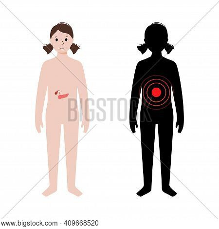 Pain Or Inflammation In Pancreas. Kid Anatomy Poster. Diabetes, Ache In Children Human Body. Interna