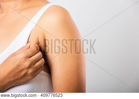 Close Up Of Asian Woman Pulling Excess Fat On Her Skin Underarm She Problem Armpit Fat Underarm Wrin