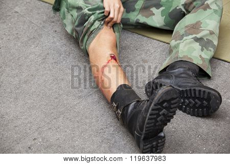 Gunshot wound