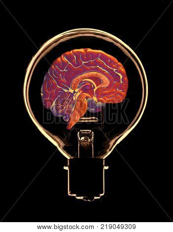 FALSE COLOUR IMAGE OF GLASS ELECTRIC LIGHT BULB CONTAINING HALF OF HUMAN BRAIN