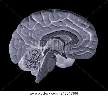 X RAY IMAGE OF LEFT HALF OF HUMAN BRAIN