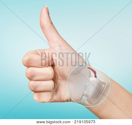 Robot hand inside human hand. Hand prosthesis concept. 3d rendering.