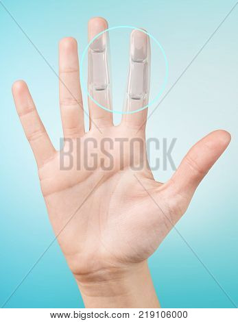 Robot hand inside human hand. Hand prosthesis concept. 3d rendering.