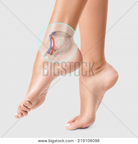 Cyborg in human skin. Circle shows robotic detail inside leg. Prosthesis concept. 3d rendering.