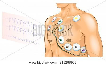 vector illustration of ECG electrodes on the chest of the athlete