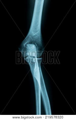 left joint X-ray image from a human body part. ideal for websites and magazines layouts