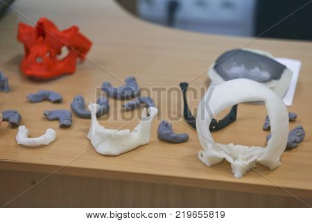 The lower jaw of a man, created on a 3d printer from a photopolymer material. Stereolithography 3D printer, technology of liquid photopolymerization under UV light. Modern medical technologies.
