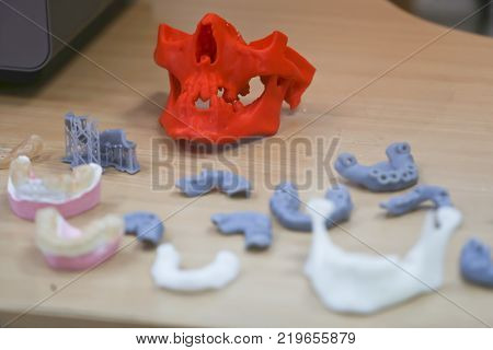 The lower jaw of a man, created on a 3d printer from a photopolymer material. Stereolithography 3D printer, technology of liquid photopolymerization under UV light. Modern medical technologies.