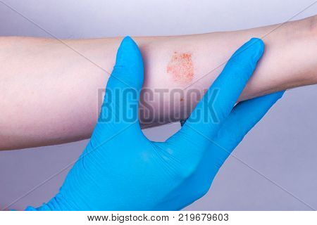 the doctor spends examining an allergic rash of patient.