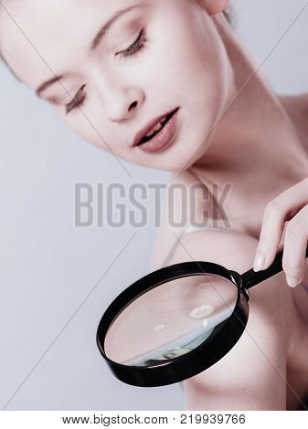 Skin control self examination concept. Yound woman holds magnifying glass in hand examining her body for melanoma suspicion. Checking benign moles.