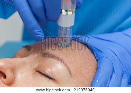 Cosmetic treatment by injection in the clinic. Use of a dermal injector to stimulate the skin. A woman receives injections of a placental-peptide serum