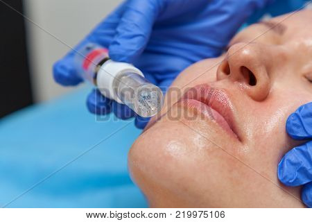 Cosmetic treatment by injection in the clinic. Use of a dermal injector to stimulate the skin. A woman receives injections of a placental-peptide serum