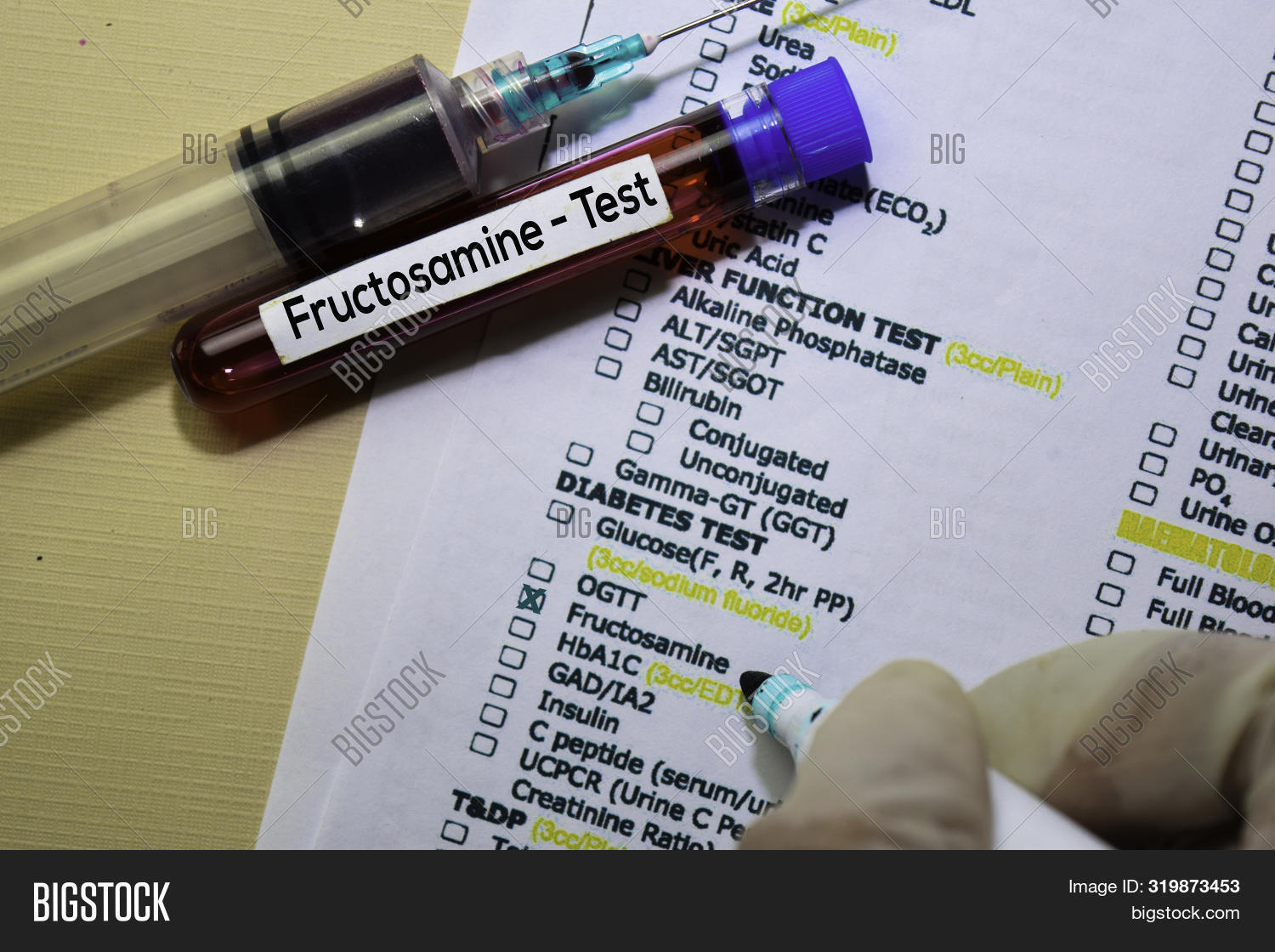 Fructosamine Test Image & Photo (Free Trial) Bigstock