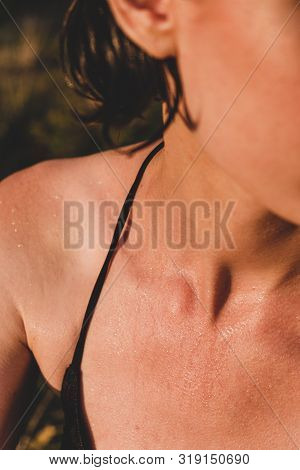 Female Skin Wet And With Goosebumps From Swimming In Cold Water. Close-up View Of Female Sitting In 