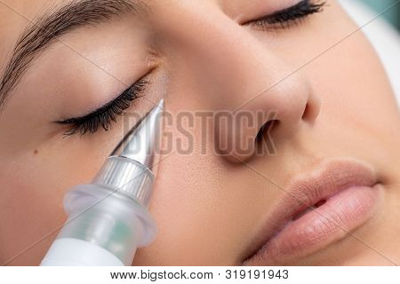 Macro Close Up Of Woman Having Noninvasive Cosmetic Facial With Plasma Pen. Cone Shaped Device Doing