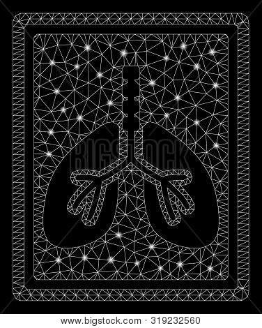 Flare Mesh Lungs Fluorography With Glitter Effect. Abstract Illuminated Model Of Lungs Fluorography 
