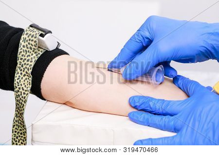 Close-up shot of doctor or nurse ready to take a blood sample from arm vein with a vacutainer. Venipuncture or venepuncture procedure