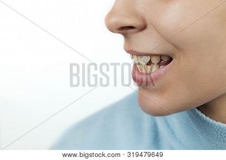 Biting is wrong. Don't bite more than you can chew картинка. Biting is wrong. Biting is wrong. Biting is wrong.