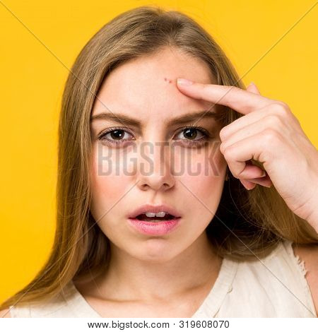 Portrait Of Sad Teen Gerl Touching Her Face And Looking For Acne On Yellow Background