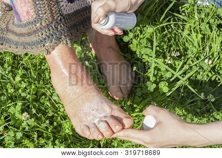 A Girl Treats The Elder Woman Who Got A Scald Of Leg