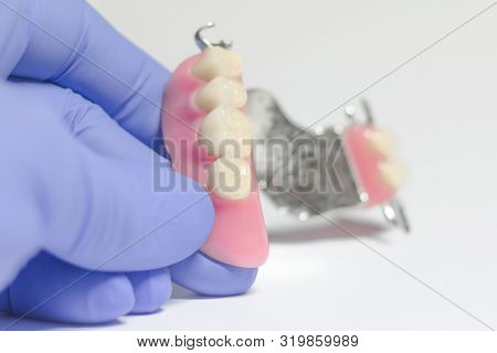 Partial Denture Of The Upper Jaw In The Hands Of A Dentist