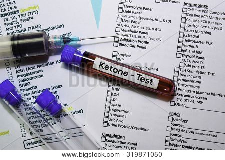 Ketone - Test With Blood Sample. Top View Isolated On Office Desk. Healthcare/medical Concept