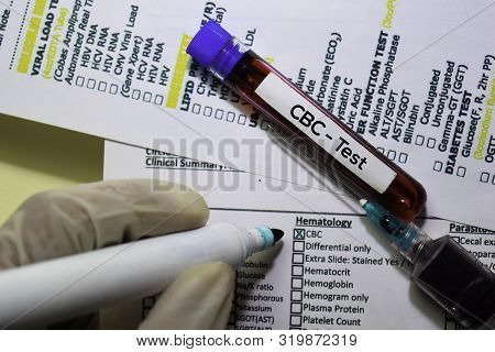 Cbc - Test With Blood Sample. Top View Isolated On Office Desk. Healthcare/medical Concept