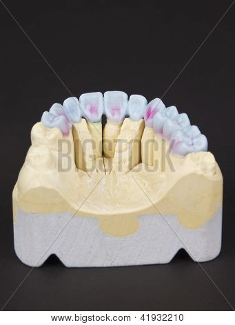 Wax gebit
